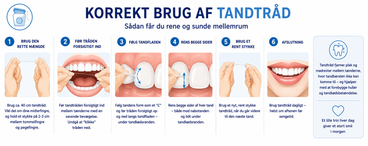 Illustration: korrekt brug af tandtråd i 6 trin