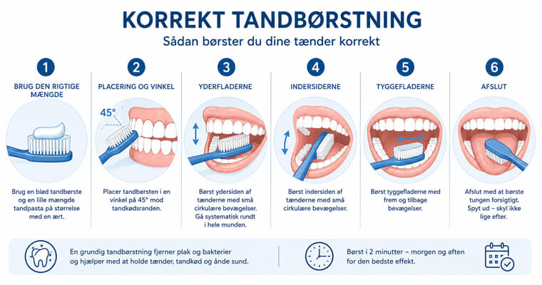 Illustration af korrekt tandbørsteteknik med vinkel mod tandkødsranden